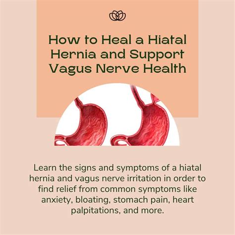 The easiest way to assess for a hiatal hernia is to place your fingers on the upper belly just below the sternum. . Hiatal hernia and vagus nerve forum